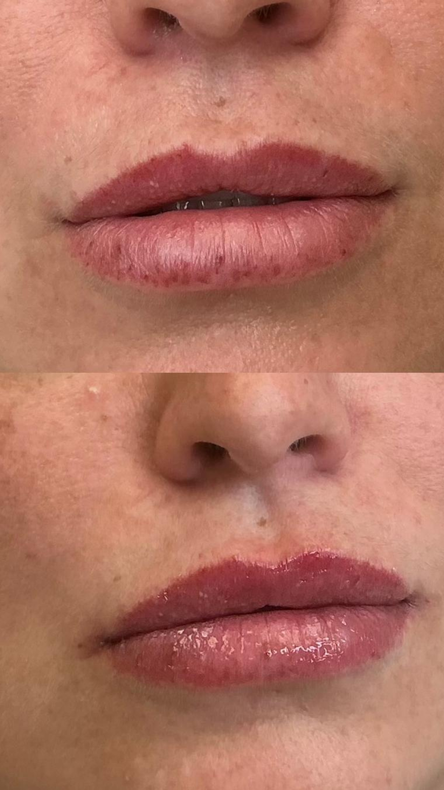 Client Result