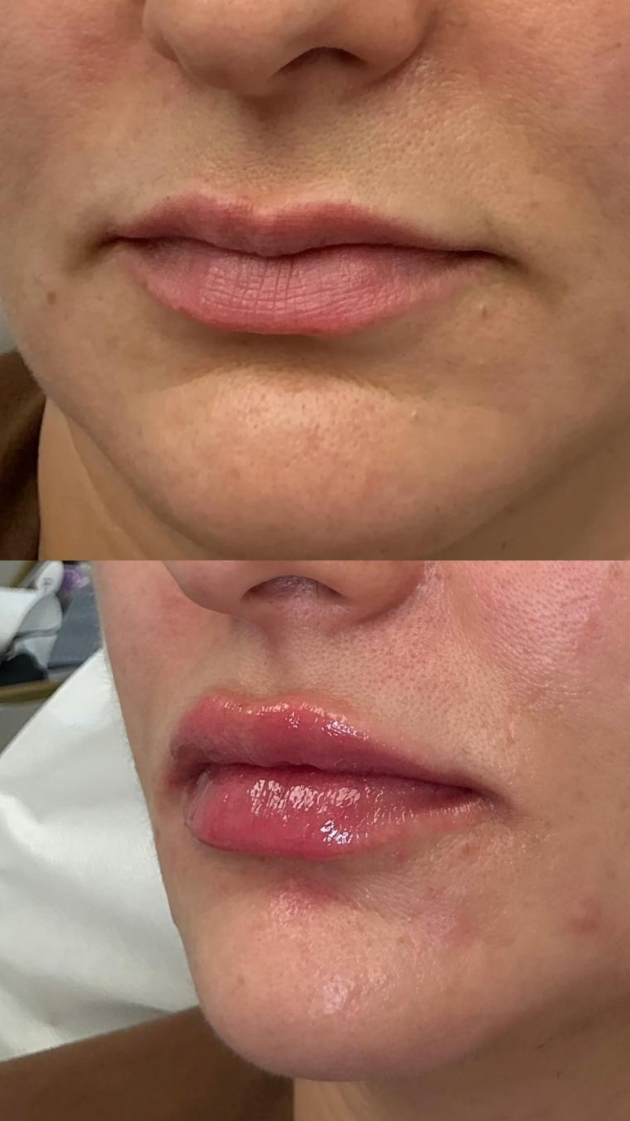 Client Result