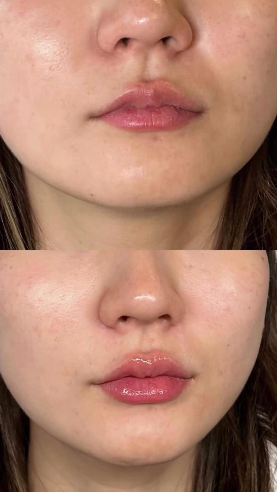 Client Result