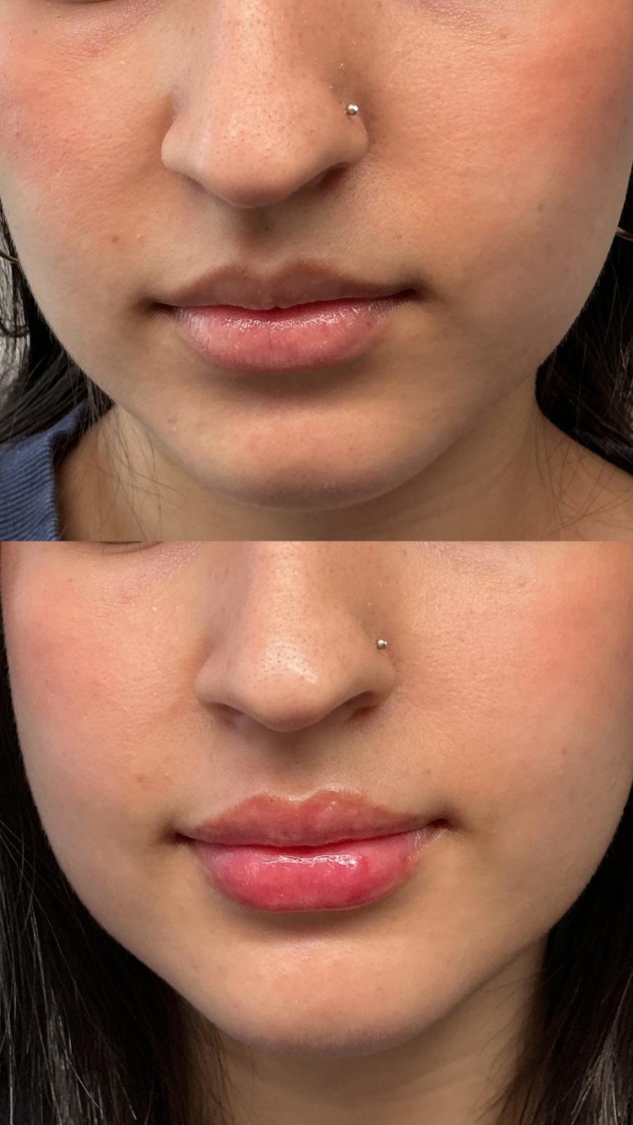 Client Result