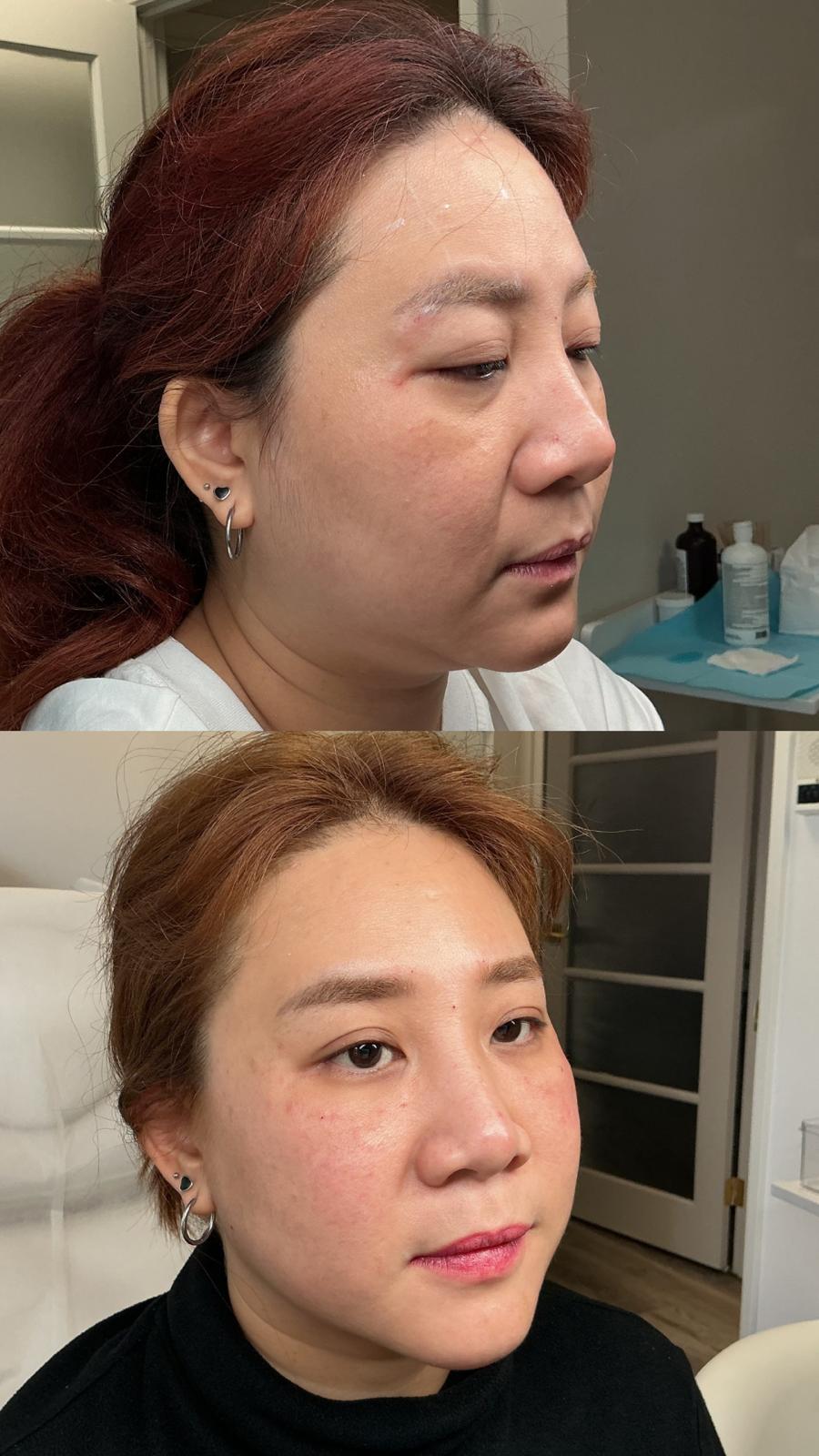 Client Result