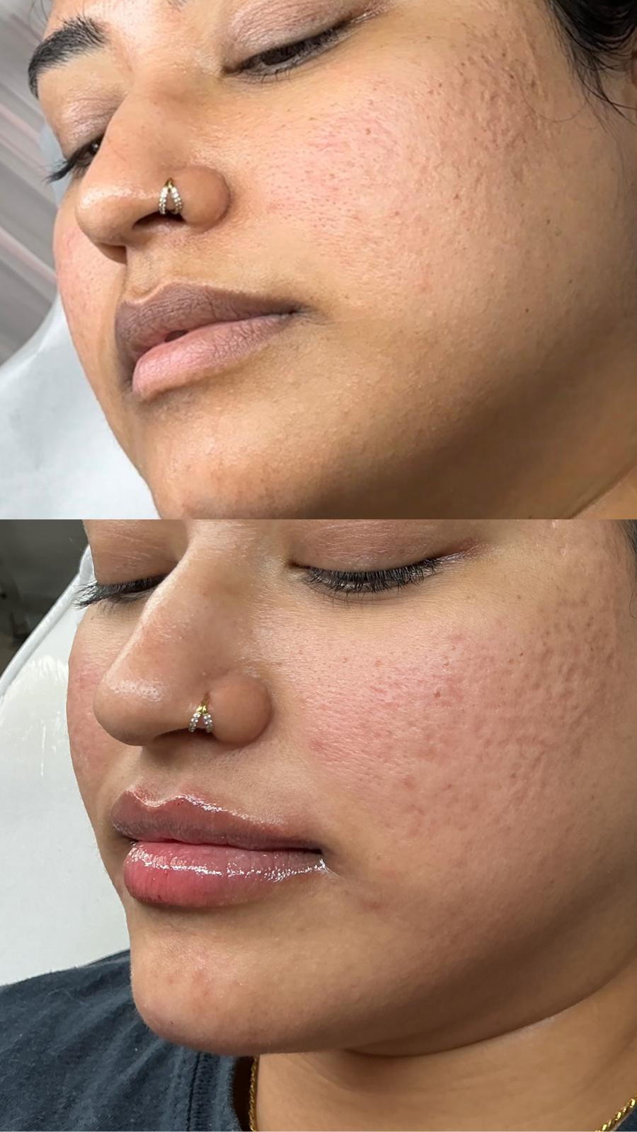 Client Result