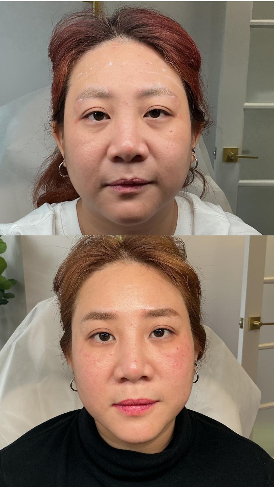 Client Result