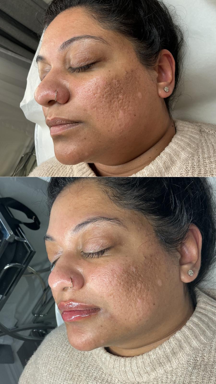 Client Result